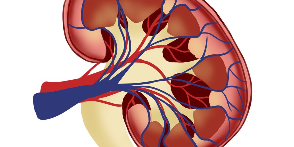 New technique detects novel biomarkers for kidney diseases with nephrotic syndrome New technique detects novel biomarkers for kidney diseases with nephrotic syndrome