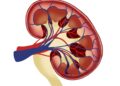 New technique detects novel biomarkers for kidney diseases with nephrotic syndrome New technique detects novel biomarkers for kidney diseases with nephrotic syndrome