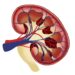 New technique detects novel biomarkers for kidney diseases with nephrotic syndrome New technique detects novel biomarkers for kidney diseases with nephrotic syndrome